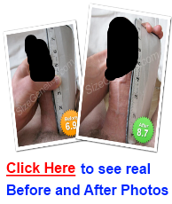 sizgenetics before and after sizgenetics before and after